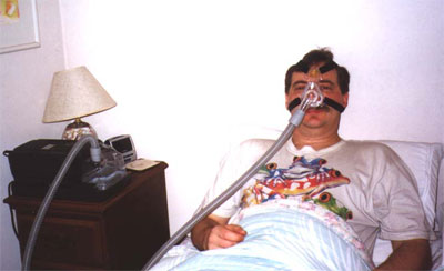 CPap, Anti-snoring devices